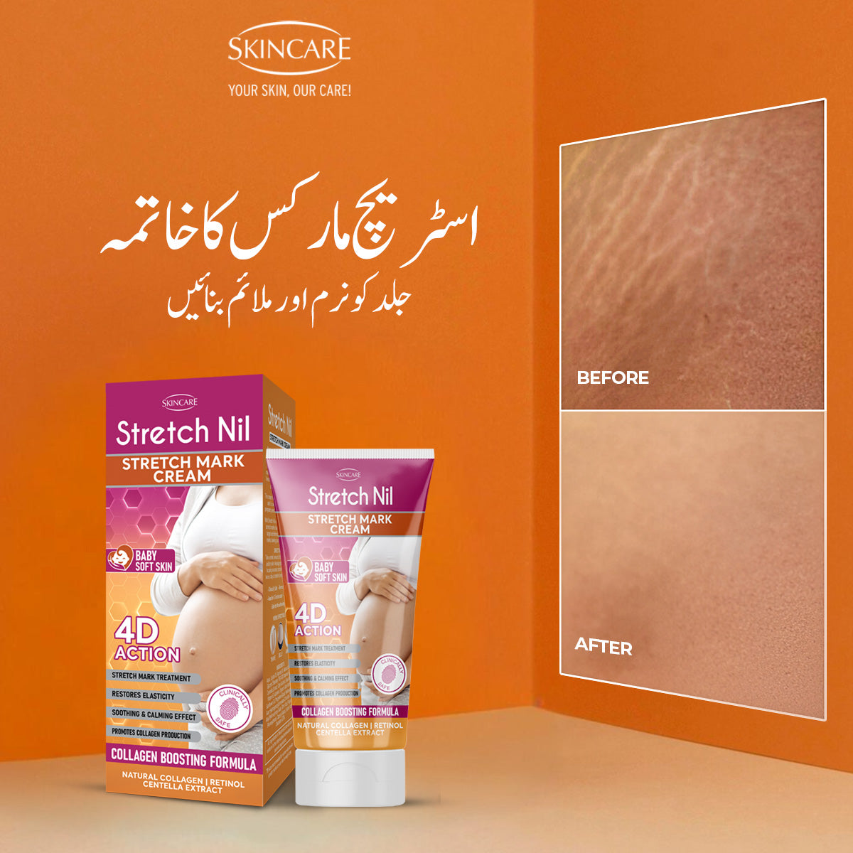 Curves & Confidence Kit